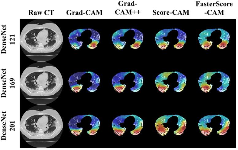 https://cdn.ncbi.nlm.nih.gov/pmc/blobs/c056/9221733/3478f2e7c417/diagnostics-12-01482-g008.jpg