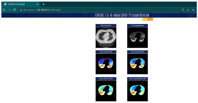 https://cdn.ncbi.nlm.nih.gov/pmc/blobs/c056/9221733/cd483ece3497/diagnostics-12-01482-g022.jpg