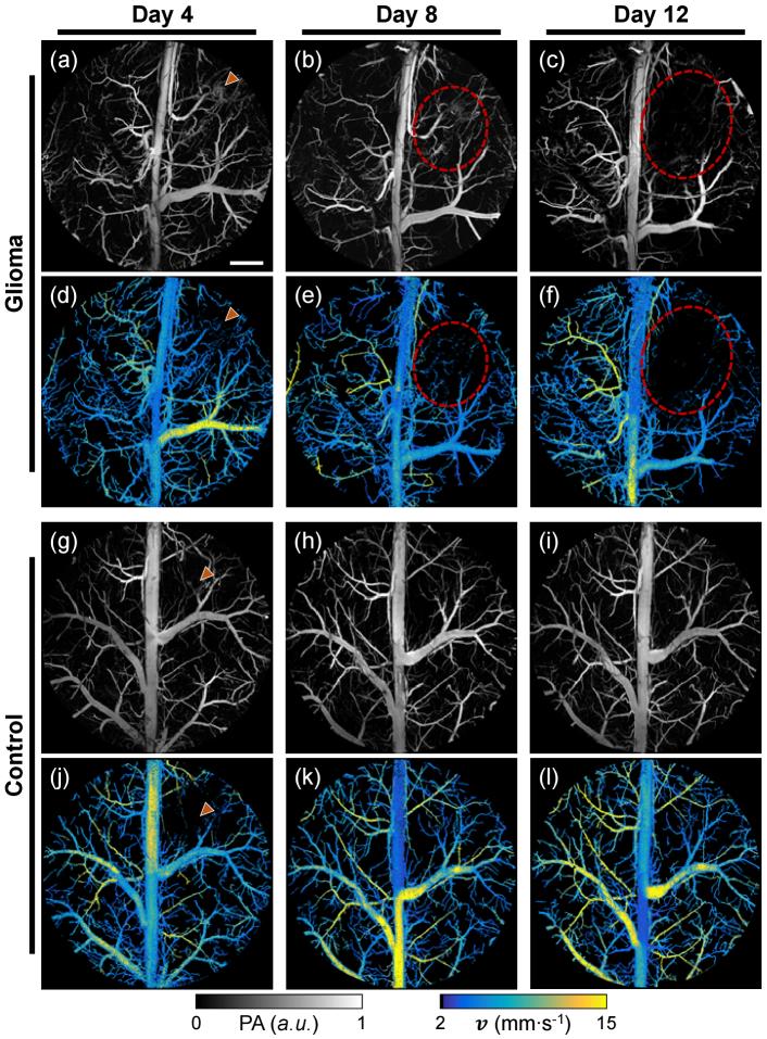 https://cdn.ncbi.nlm.nih.gov/pmc/blobs/c05a/11019678/567672a123f0/boe-15-4-2419-g003.jpg