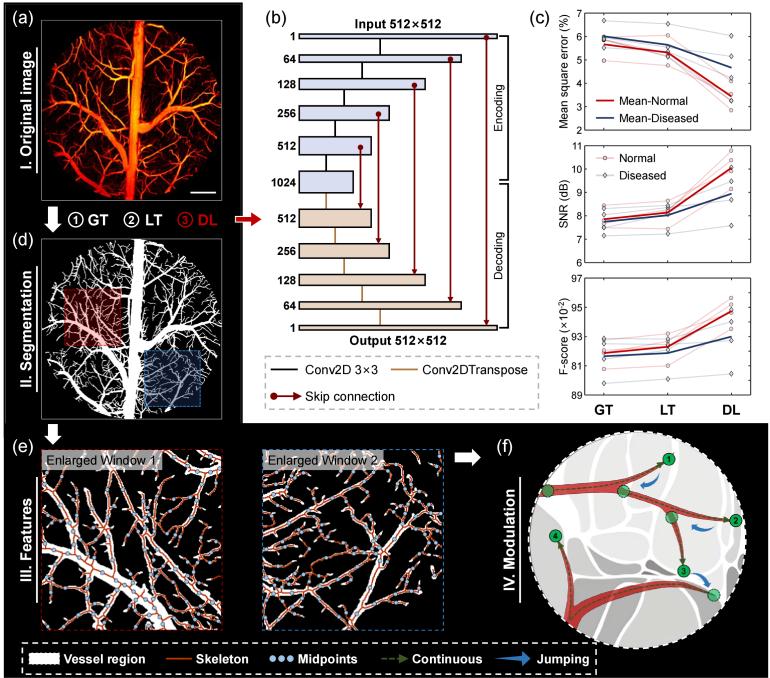 https://cdn.ncbi.nlm.nih.gov/pmc/blobs/c05a/11019678/c988f652072f/boe-15-4-2419-g002.jpg