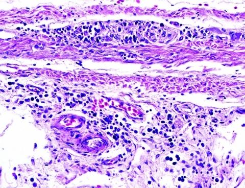 https://cdn.ncbi.nlm.nih.gov/pmc/blobs/c05d/3322028/5316fdb4569c/09-1257-F3.jpg