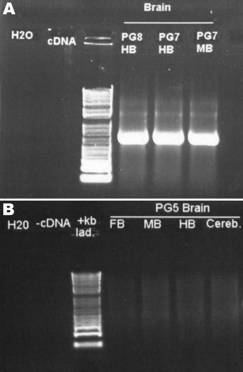 https://cdn.ncbi.nlm.nih.gov/pmc/blobs/c05d/3322028/d06f353d79af/09-1257-F5.jpg