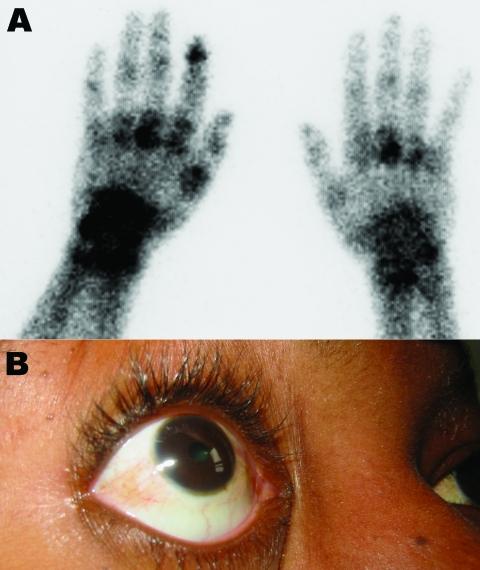 https://cdn.ncbi.nlm.nih.gov/pmc/blobs/c05f/3290960/3c5e892b25ef/06-0610-F2.jpg