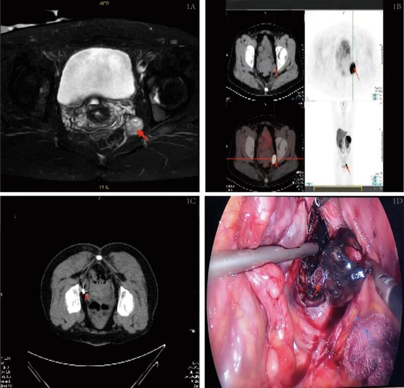 https://cdn.ncbi.nlm.nih.gov/pmc/blobs/c061/11615929/28460fd061bf/gr1.jpg