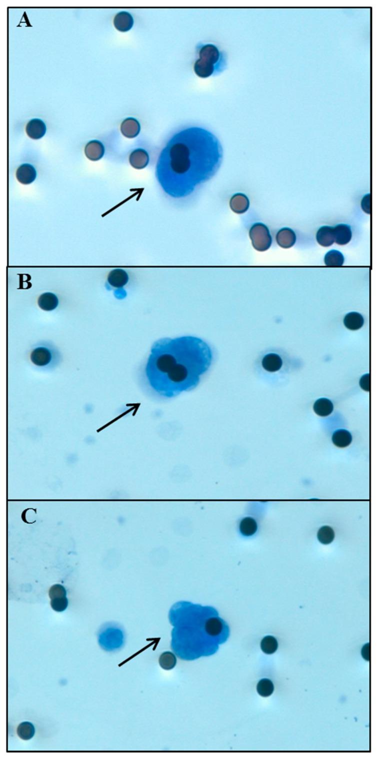 https://cdn.ncbi.nlm.nih.gov/pmc/blobs/c061/5454947/4aaa16a1e5d0/ijms-18-01035-g003.jpg