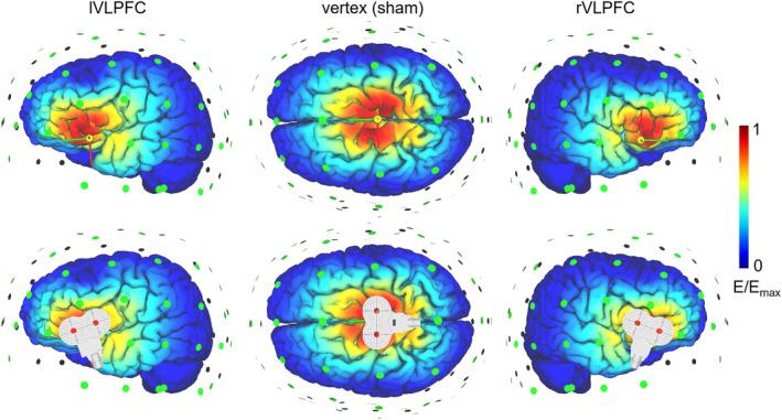 https://cdn.ncbi.nlm.nih.gov/pmc/blobs/c067/9120569/1372110d282a/HBM-43-2898-g004.jpg