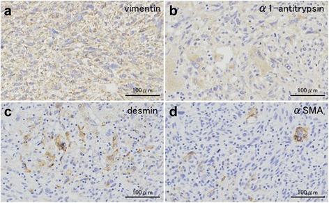 https://cdn.ncbi.nlm.nih.gov/pmc/blobs/c068/5285294/0c455202c96b/40792_2017_295_Fig5_HTML.jpg