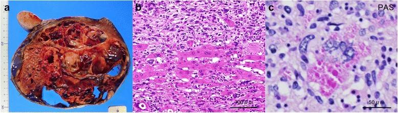 https://cdn.ncbi.nlm.nih.gov/pmc/blobs/c068/5285294/cb33b42a642b/40792_2017_295_Fig4_HTML.jpg