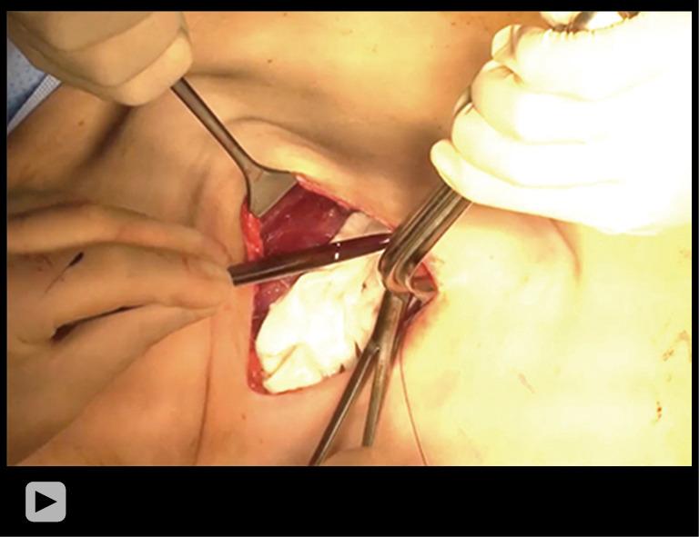https://cdn.ncbi.nlm.nih.gov/pmc/blobs/c06e/11247577/3ff2a2514c97/gs-13-06-852-vidS.1.jpg
