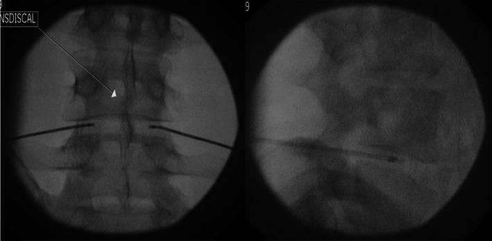 https://cdn.ncbi.nlm.nih.gov/pmc/blobs/c078/12301617/5e8a2650b458/PAPR-25-0-g004.jpg