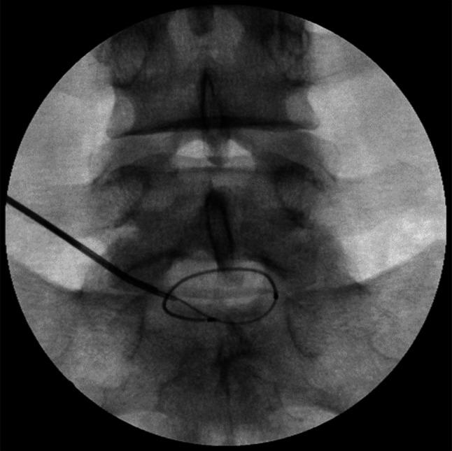 https://cdn.ncbi.nlm.nih.gov/pmc/blobs/c078/12301617/c603bb8b04a2/PAPR-25-0-g006.jpg