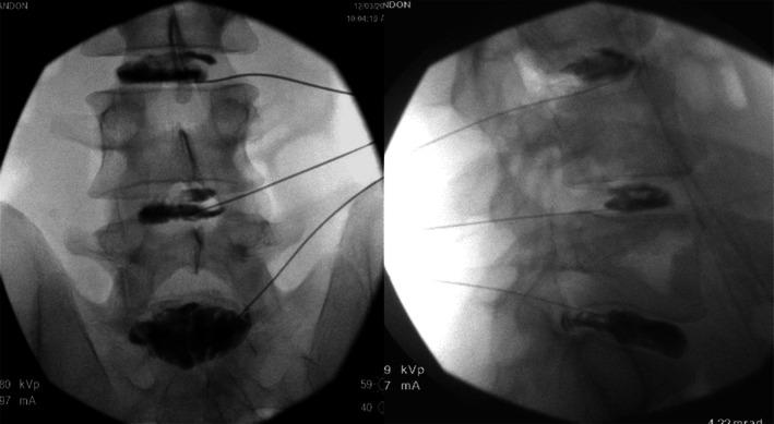 https://cdn.ncbi.nlm.nih.gov/pmc/blobs/c078/12301617/fdce5e3653bf/PAPR-25-0-g005.jpg