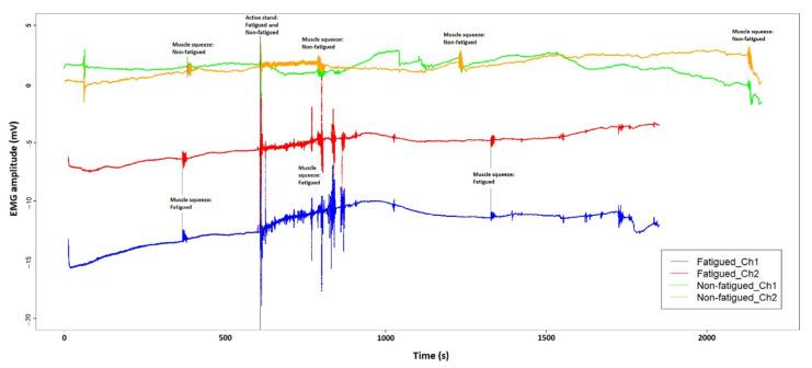 https://cdn.ncbi.nlm.nih.gov/pmc/blobs/c07d/8914998/82ce9b86ba8b/sensors-22-01758-g006.jpg