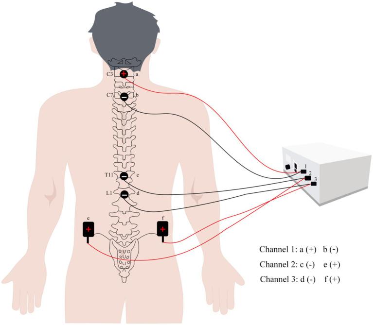 https://cdn.ncbi.nlm.nih.gov/pmc/blobs/c080/11140104/ffe391eb1efa/fnins-18-1380467-g003.jpg