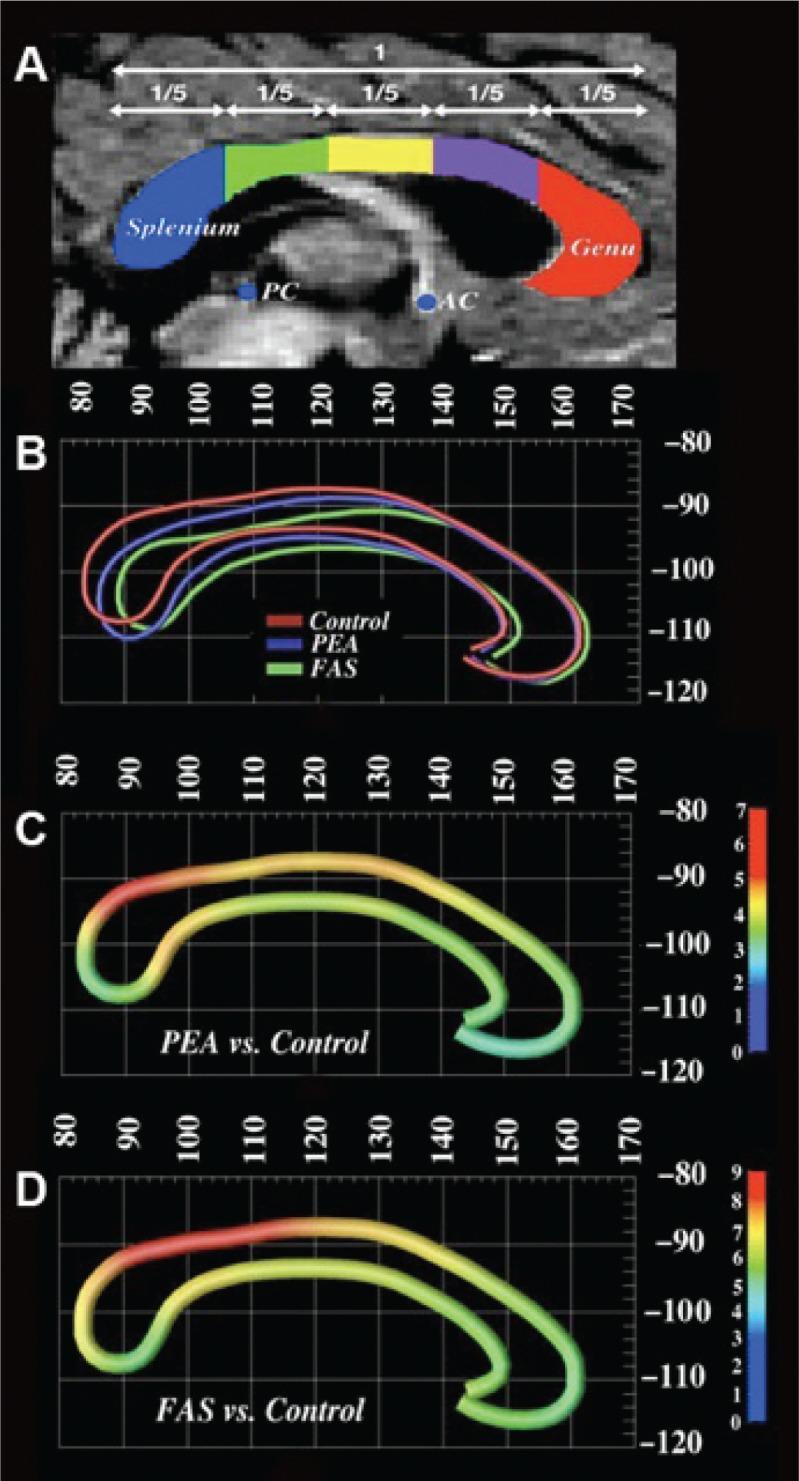 https://cdn.ncbi.nlm.nih.gov/pmc/blobs/c083/3860550/25a03607d032/arh-34-1-121f4.jpg