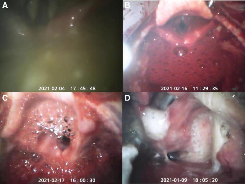 https://cdn.ncbi.nlm.nih.gov/pmc/blobs/c08c/10735139/a18d54bbaaa5/medi-102-e36761-g002.jpg