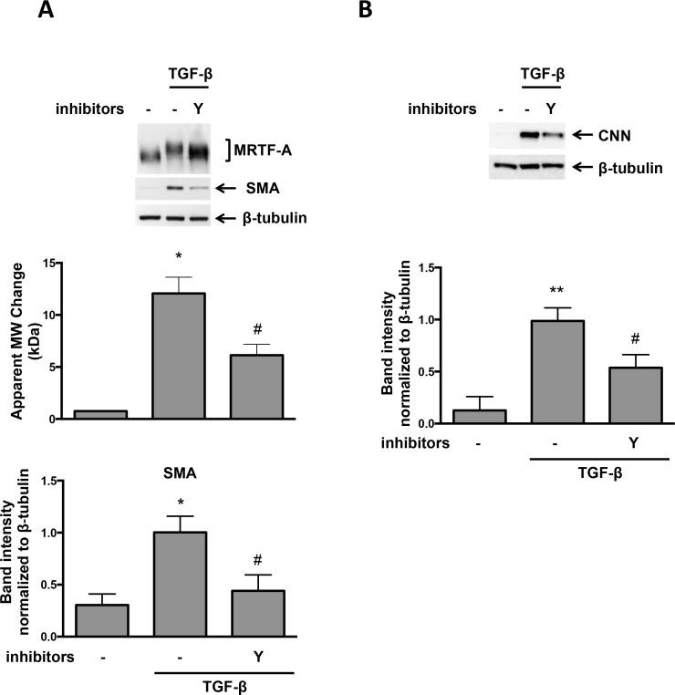 https://cdn.ncbi.nlm.nih.gov/pmc/blobs/c08e/4835087/312362222eaf/pone.0153199.g004.jpg