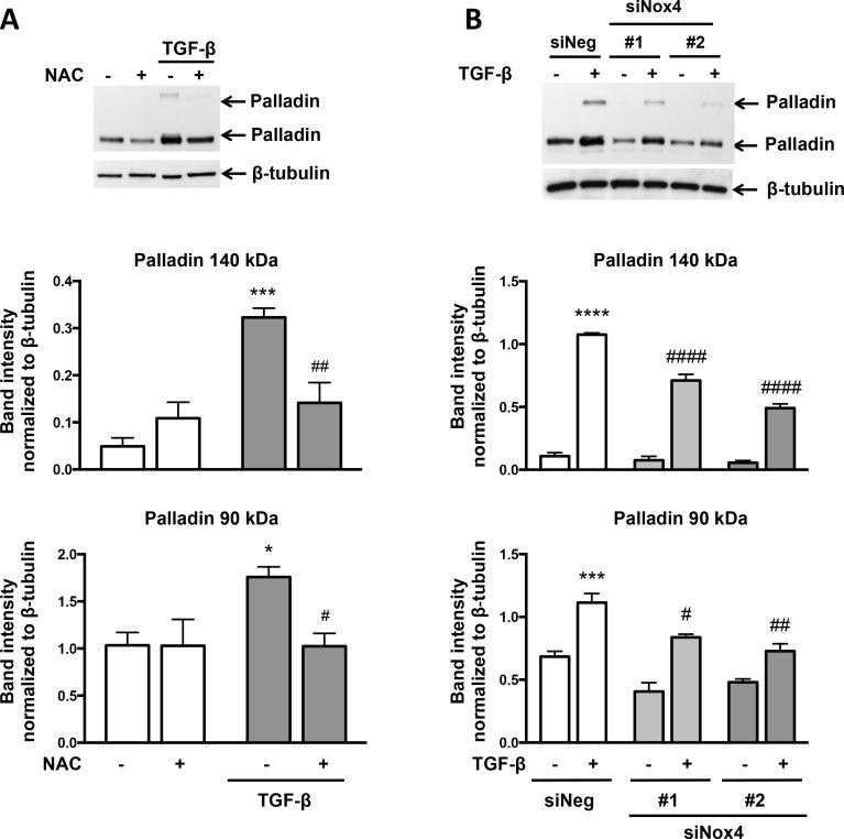 https://cdn.ncbi.nlm.nih.gov/pmc/blobs/c08e/4835087/8751bcb10fb2/pone.0153199.g006.jpg