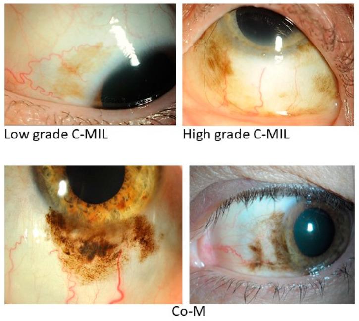https://cdn.ncbi.nlm.nih.gov/pmc/blobs/c08f/11429624/cc796e556df4/cancers-16-03121-g001.jpg