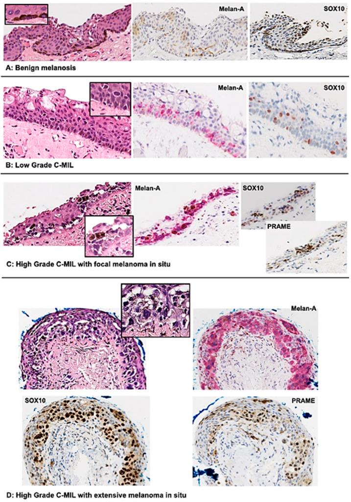 https://cdn.ncbi.nlm.nih.gov/pmc/blobs/c08f/11429624/f1f8bf2196d3/cancers-16-03121-g003.jpg