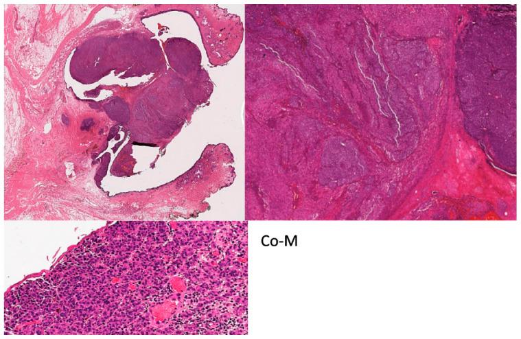 https://cdn.ncbi.nlm.nih.gov/pmc/blobs/c08f/11429624/f6abc78cd5eb/cancers-16-03121-g002.jpg