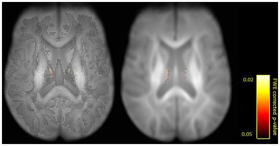https://cdn.ncbi.nlm.nih.gov/pmc/blobs/c096/10773749/5e86f1af96d9/fnins-17-1293133-g002.jpg