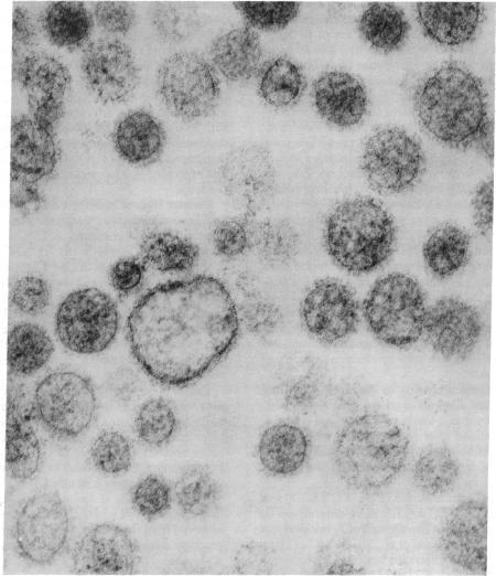 https://cdn.ncbi.nlm.nih.gov/pmc/blobs/c096/346457/60fdcf010d01/pnas00450-0158-a.jpg