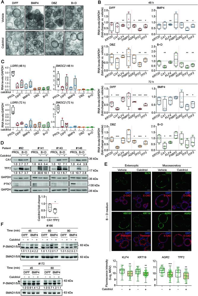https://cdn.ncbi.nlm.nih.gov/pmc/blobs/c09a/11058856/4514b33b1b20/41419_2024_6680_Fig5_HTML.jpg