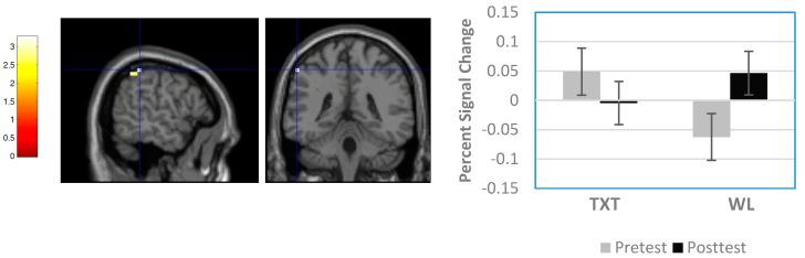 https://cdn.ncbi.nlm.nih.gov/pmc/blobs/c09d/5789338/33f2fd2743c9/brainsci-08-00007-g004.jpg