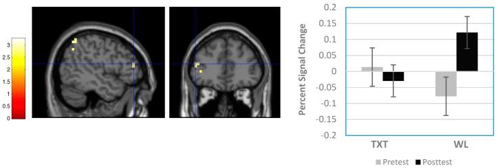 https://cdn.ncbi.nlm.nih.gov/pmc/blobs/c09d/5789338/882dab842ddb/brainsci-08-00007-g003.jpg
