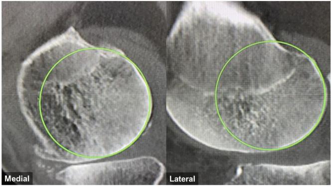 https://cdn.ncbi.nlm.nih.gov/pmc/blobs/c0a5/12392390/fcc44973b780/KSA-33-3261-g005.jpg