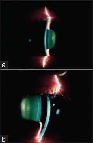 https://cdn.ncbi.nlm.nih.gov/pmc/blobs/c0a9/4065517/0dc636013afc/IJO-62-619-g003.jpg