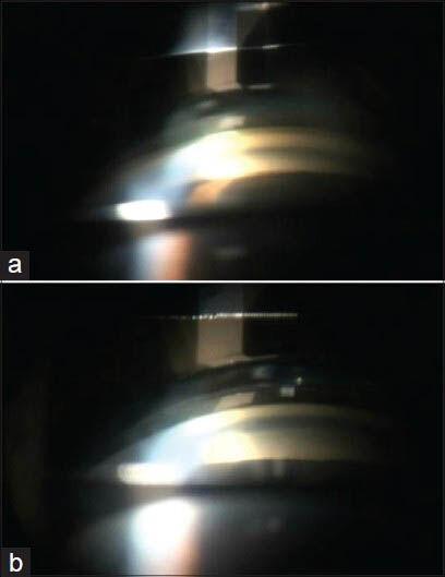 https://cdn.ncbi.nlm.nih.gov/pmc/blobs/c0a9/4065517/24a706828036/IJO-62-619-g004.jpg