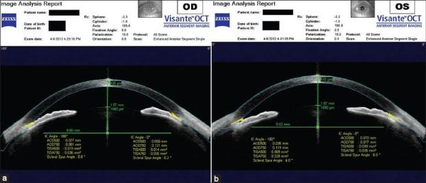 https://cdn.ncbi.nlm.nih.gov/pmc/blobs/c0a9/4065517/6f309fdd9ba5/IJO-62-619-g005.jpg