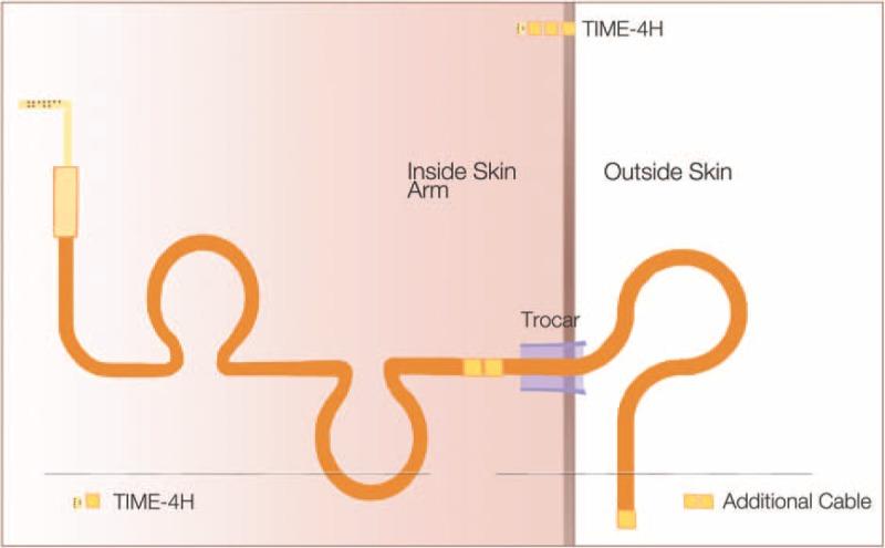 https://cdn.ncbi.nlm.nih.gov/pmc/blobs/c0aa/5521907/1b4221043c1b/medi-96-e7528-g002.jpg