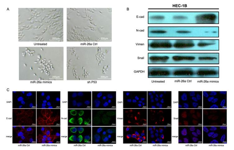 https://cdn.ncbi.nlm.nih.gov/pmc/blobs/c0ba/4792583/32903e81cd84/oncotarget-06-44660-g007.jpg