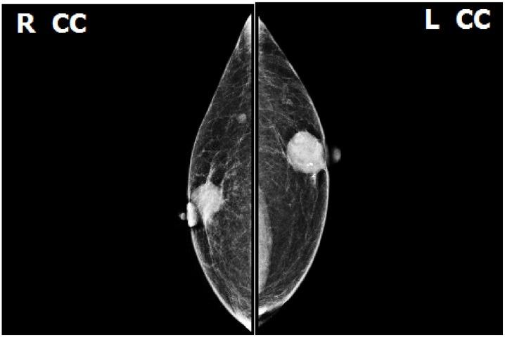 https://cdn.ncbi.nlm.nih.gov/pmc/blobs/c0c2/7233884/4ca7b1f18c7c/10.1177_2050313X20917841-fig1.jpg