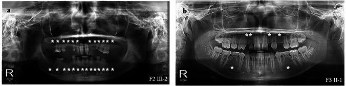 https://cdn.ncbi.nlm.nih.gov/pmc/blobs/c0c5/10756872/c91bc0180c36/784_2023_5415_Fig2_HTML.jpg