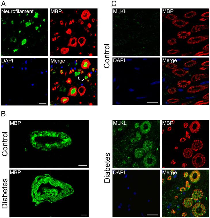 https://cdn.ncbi.nlm.nih.gov/pmc/blobs/c0c5/9168919/139a922a35d8/pnas.2121552119fig05.jpg