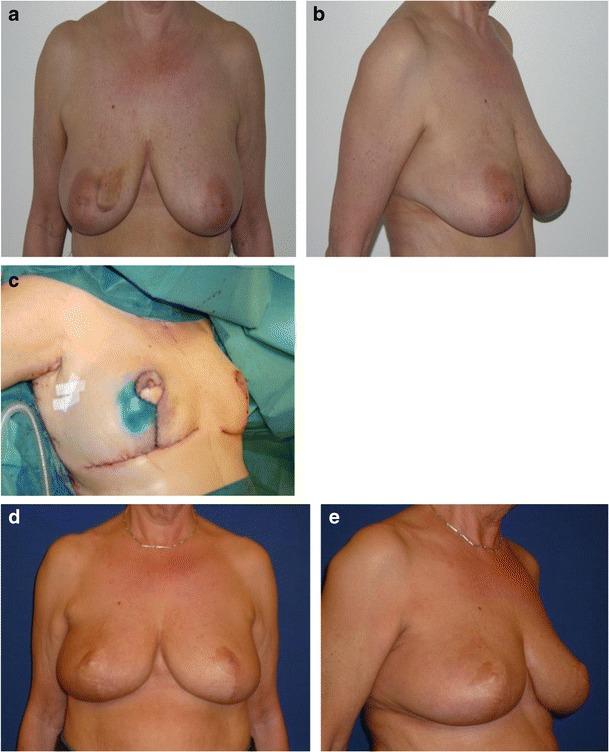 https://cdn.ncbi.nlm.nih.gov/pmc/blobs/c0cb/3950564/98c9df179e18/238_2013_922_Fig4_HTML.jpg