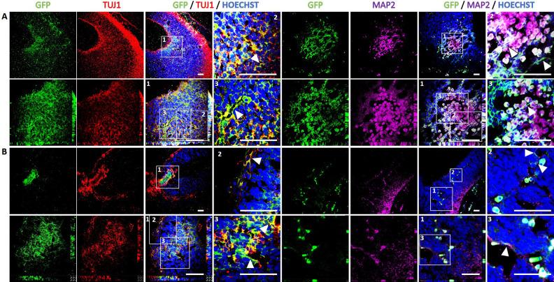 https://cdn.ncbi.nlm.nih.gov/pmc/blobs/c0ce/7809298/e9a4865dafa2/10.1177_0963689720978219-fig7.jpg