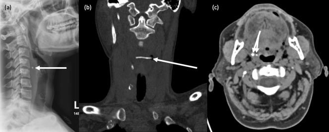 https://cdn.ncbi.nlm.nih.gov/pmc/blobs/c0cf/10461270/198f3839073e/bjr.20230046.g008.jpg