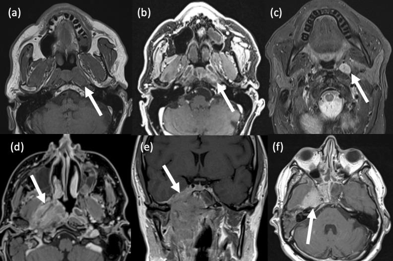 https://cdn.ncbi.nlm.nih.gov/pmc/blobs/c0cf/10461270/d1a64e3517d7/bjr.20230046.g010.jpg