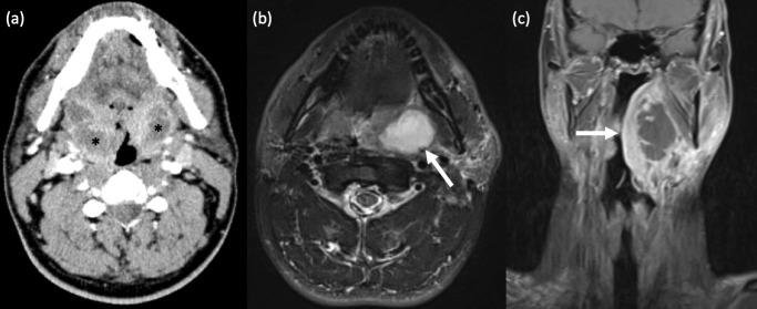 https://cdn.ncbi.nlm.nih.gov/pmc/blobs/c0cf/10461270/dd95cd4ddedf/bjr.20230046.g004.jpg