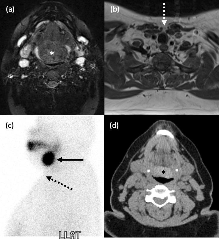 https://cdn.ncbi.nlm.nih.gov/pmc/blobs/c0cf/10461270/f464acb98f46/bjr.20230046.g005.jpg
