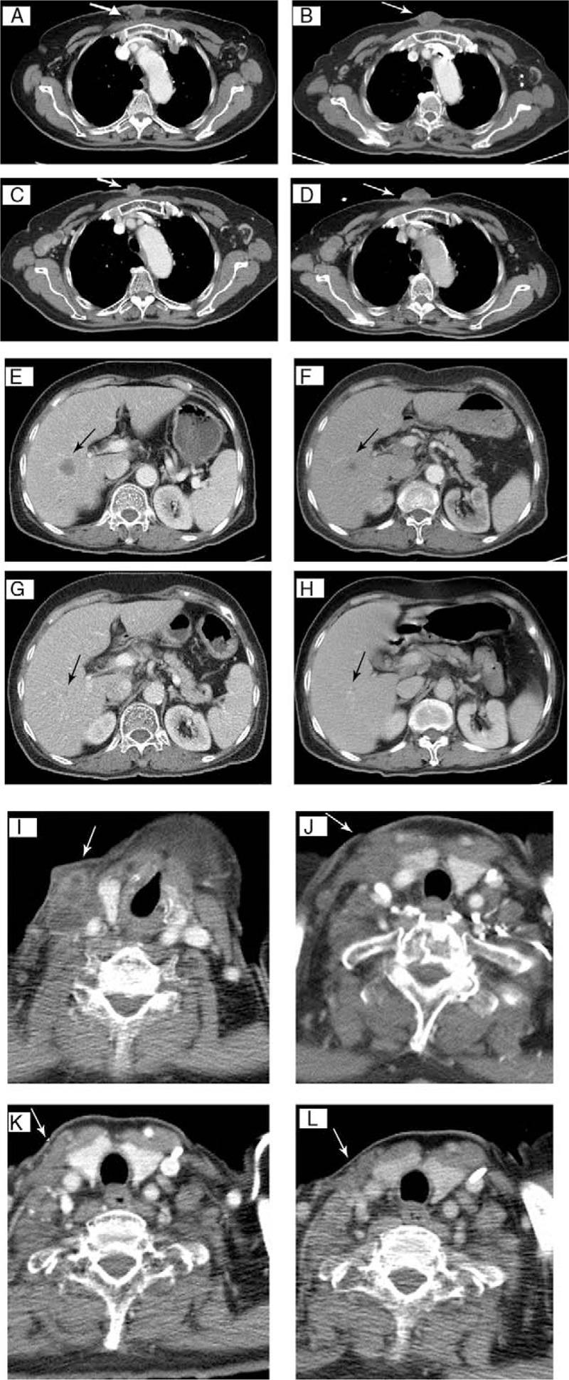 https://cdn.ncbi.nlm.nih.gov/pmc/blobs/c0de/6392576/6558a3a92d4e/medi-96-e9519-g005.jpg