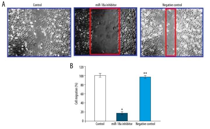 https://cdn.ncbi.nlm.nih.gov/pmc/blobs/c0e3/7081926/3c5d6468f0df/medscimonit-26-e921288-g007.jpg