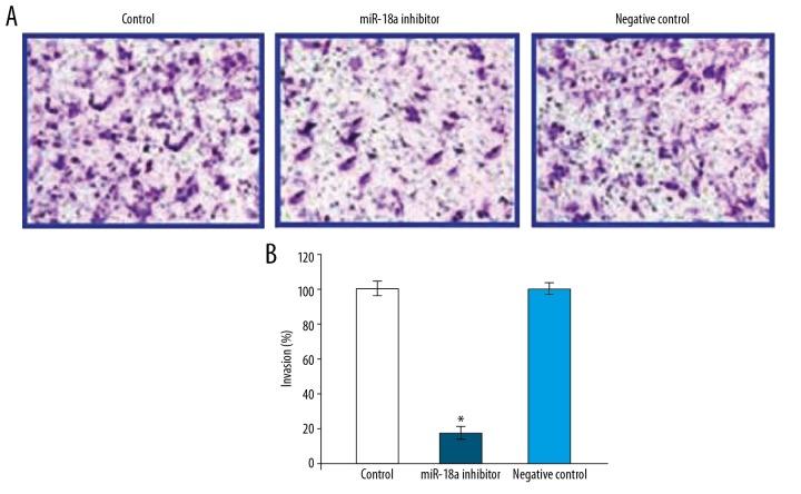 https://cdn.ncbi.nlm.nih.gov/pmc/blobs/c0e3/7081926/43b26e68d427/medscimonit-26-e921288-g006.jpg