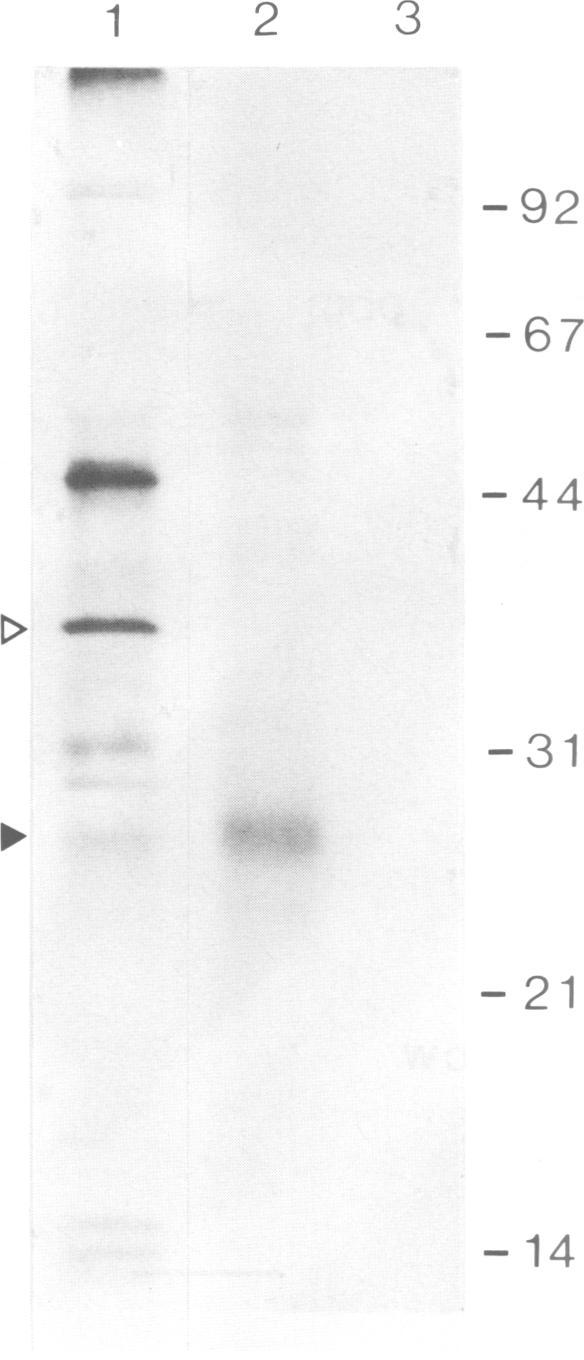 https://cdn.ncbi.nlm.nih.gov/pmc/blobs/c0e4/554620/21469213a4ec/emboj00277-0011-a.jpg