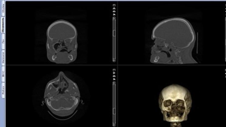 https://cdn.ncbi.nlm.nih.gov/pmc/blobs/c0e9/11164848/0ed580426b5c/40729_2024_545_Fig1_HTML.jpg